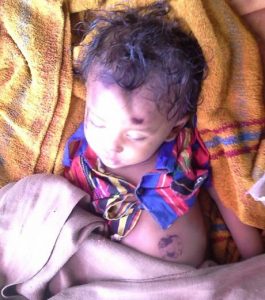 dead-child_banka bihar